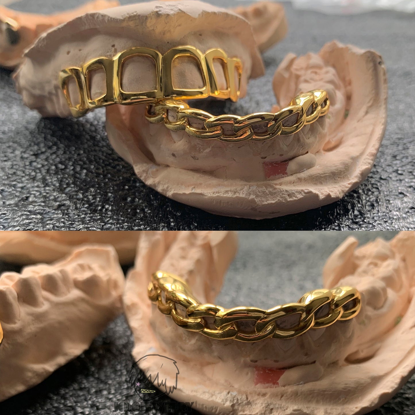 Open Face Grillz