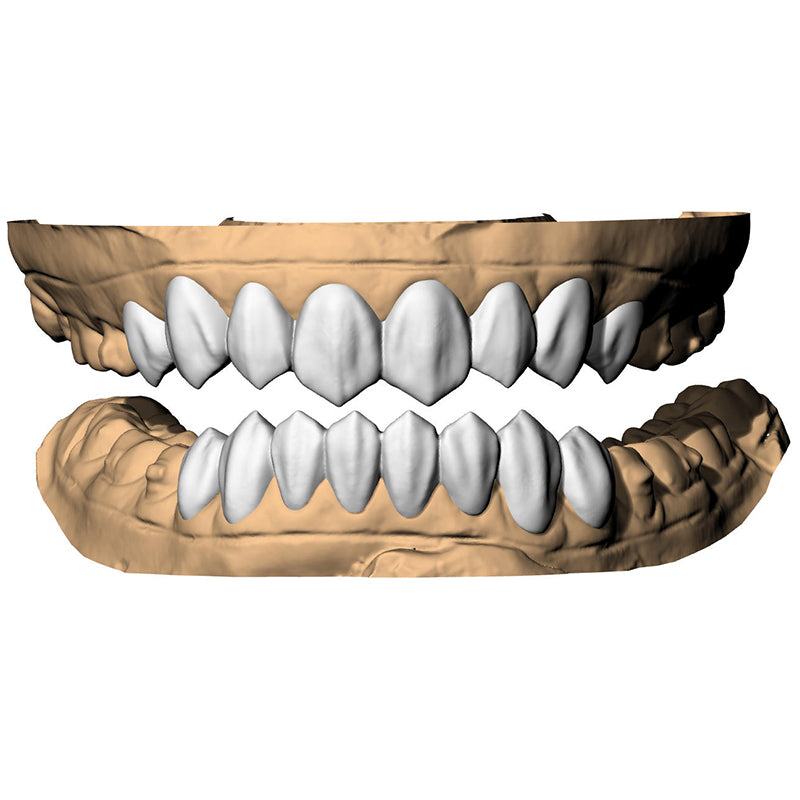 Shark Tooth Grillz – Custom Resin Shark Teeth Grillz
