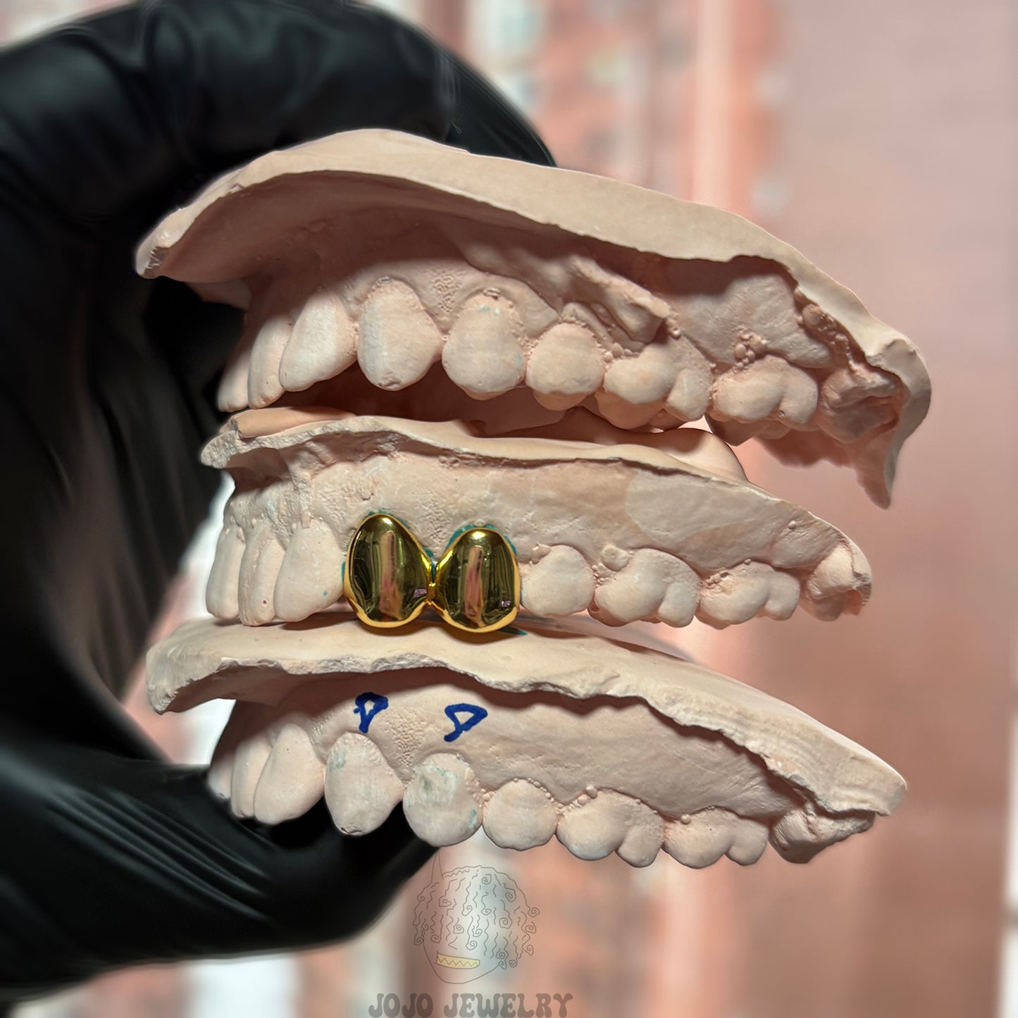 Double Cap Grillz