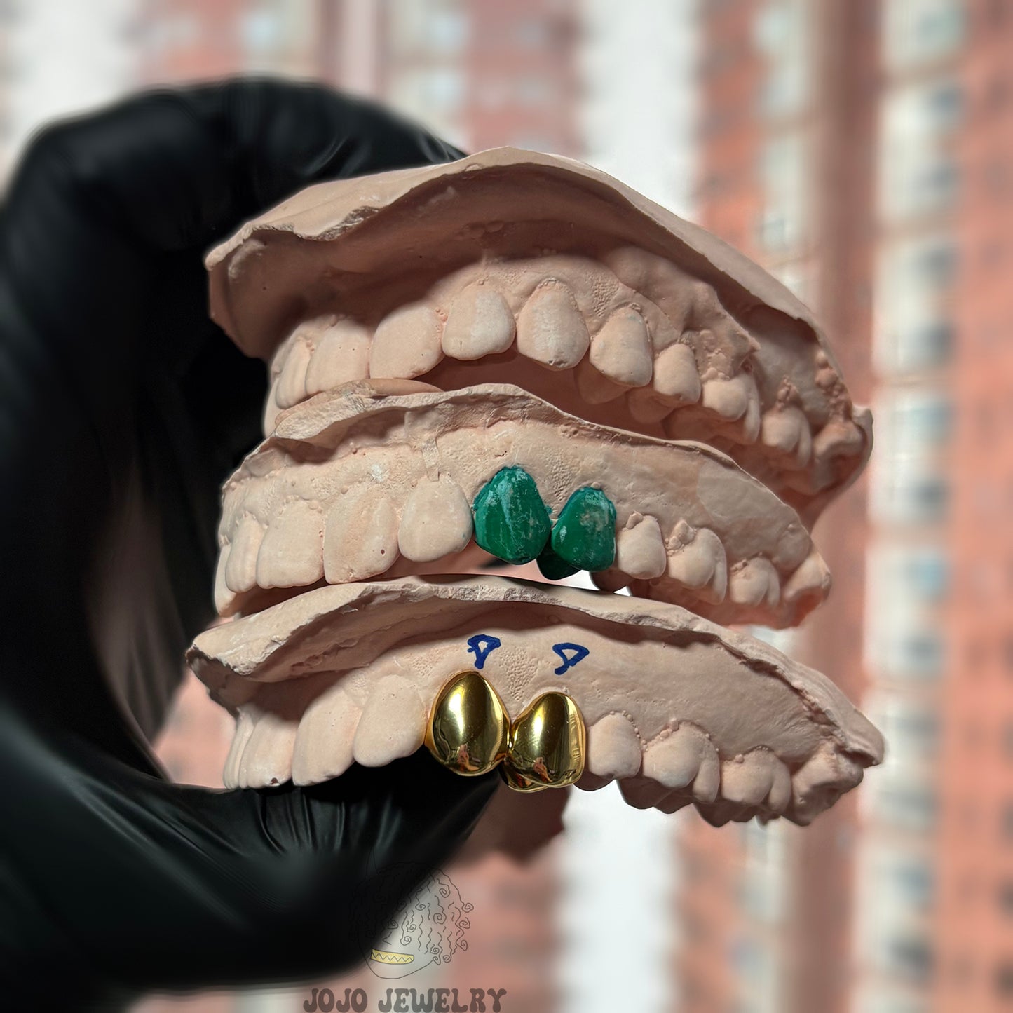 Double Cap Grillz