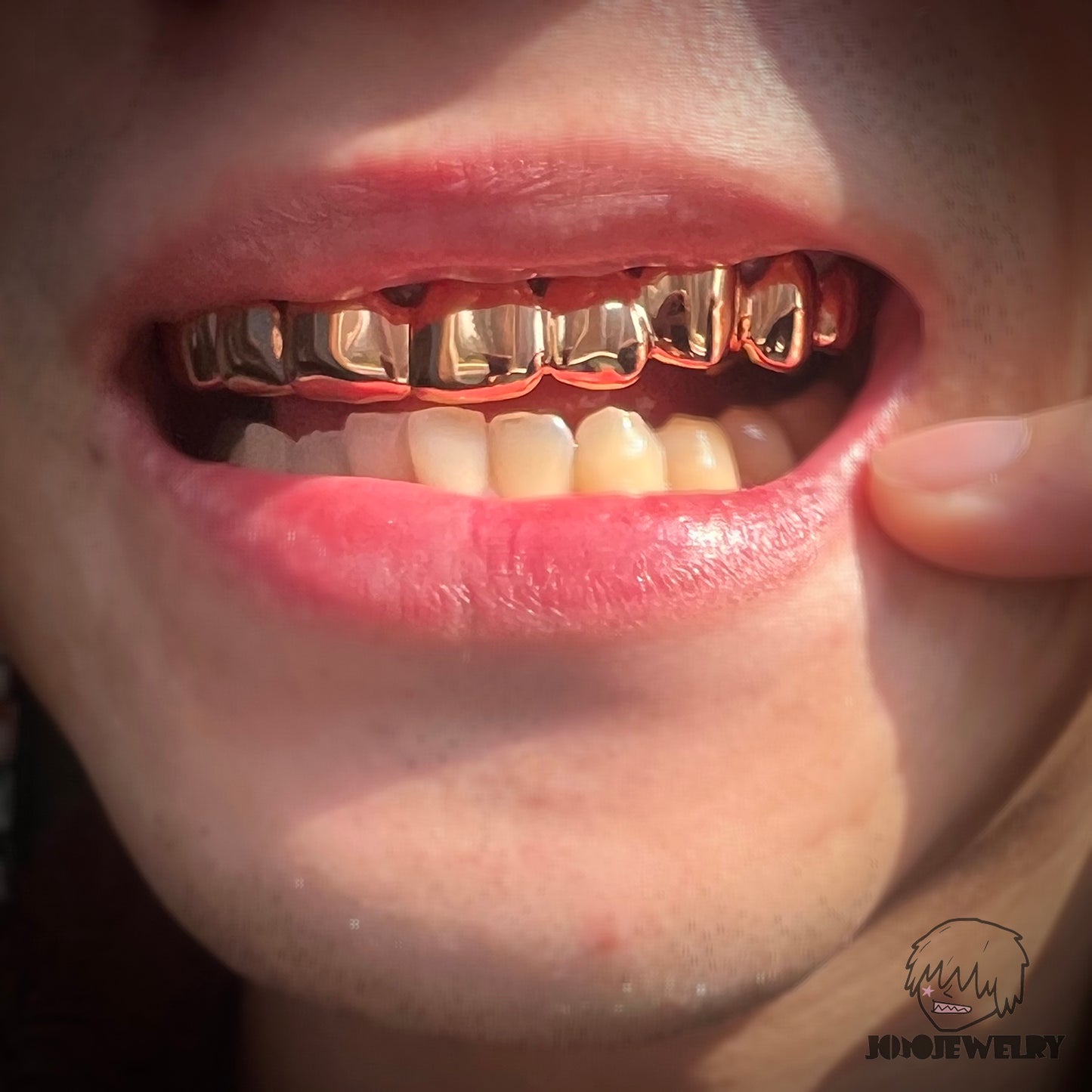 Rose Gold Grillz – Custom High Polish Tooth Grillz