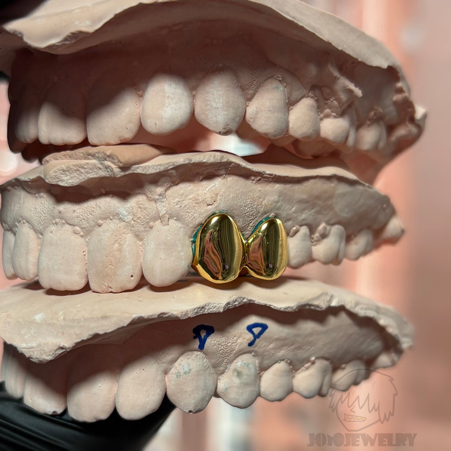 Double Cap Grillz